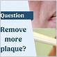 can an electric toothbrush remove plaque