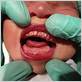 can babies get gum disease