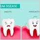 can bad gum disease be treated