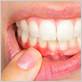 can cancer cause gum disease