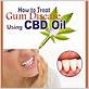 can cbd oil help gum disease