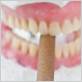 can chewing tobacco damage dental implants or crowns