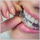 can dirty retainers cause gum disease