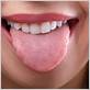 can dry mouth cause gum disease