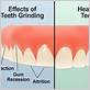 can grinding your teeth cause gum disease