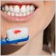 can gum disease be cured by brushing