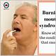 can gum disease cause burning mouth syndrome