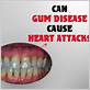 can gum disease cause heart attacks