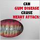 can gum disease cause heart problems