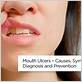 can gum disease cause mouth ulcers
