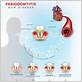 can gum disease cause serious disorders of the heart valves
