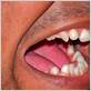 can gum disease cause tinnitus
