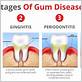 can gum disease cause weight gain