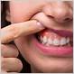 can gum disease make your throat hurt