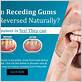 can gum loss be reversed