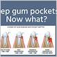 can gum pockets heal