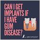 can i get implants if i have gum disease