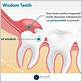 can impacted wisdom teeth cause gum disease