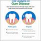 can probiotics cause gum disease