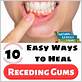 can salt water reverse gum disease