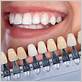can teeth whitening cause gum disease