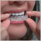 can wearing a retainer cause gum disease