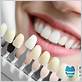 can you get teeth whitened with gum disease