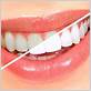 can you get teeth whitening with gum disease
