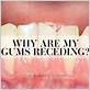 can you have implants if you have gum disease