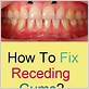 can you repair gum disease