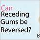 can you reverse gum disease without surgery