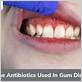 can you take antibiotics for gum disease