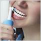 can you use an electric toothbrush on a temporary filling