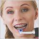 can you use an electric toothbrush when you have braces