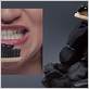 can you use charcoal toothpaste when you have gum disease