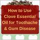can you use clove oil for gum disease