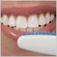 can you use electric toothbrush on veneers