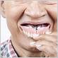can you wear dentures with gum disease