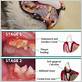 cat gum disease symptoms