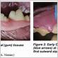 cavalier king charles gum disease