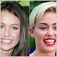 celebrities who have gum disease