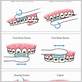 charters method of toothbrushing