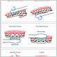 charters toothbrush method