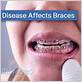 clear braces and gum disease