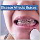 clear braces gum disease