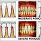 cosmetic dentistry gum disease