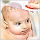 cradle cap toothbrush