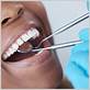 crescent city gum disease treatments