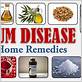 cure for gum disease home remedy