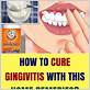 cure gingivitis at home